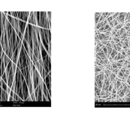 media/acfgallery/content/30/2/fibre1_original.png